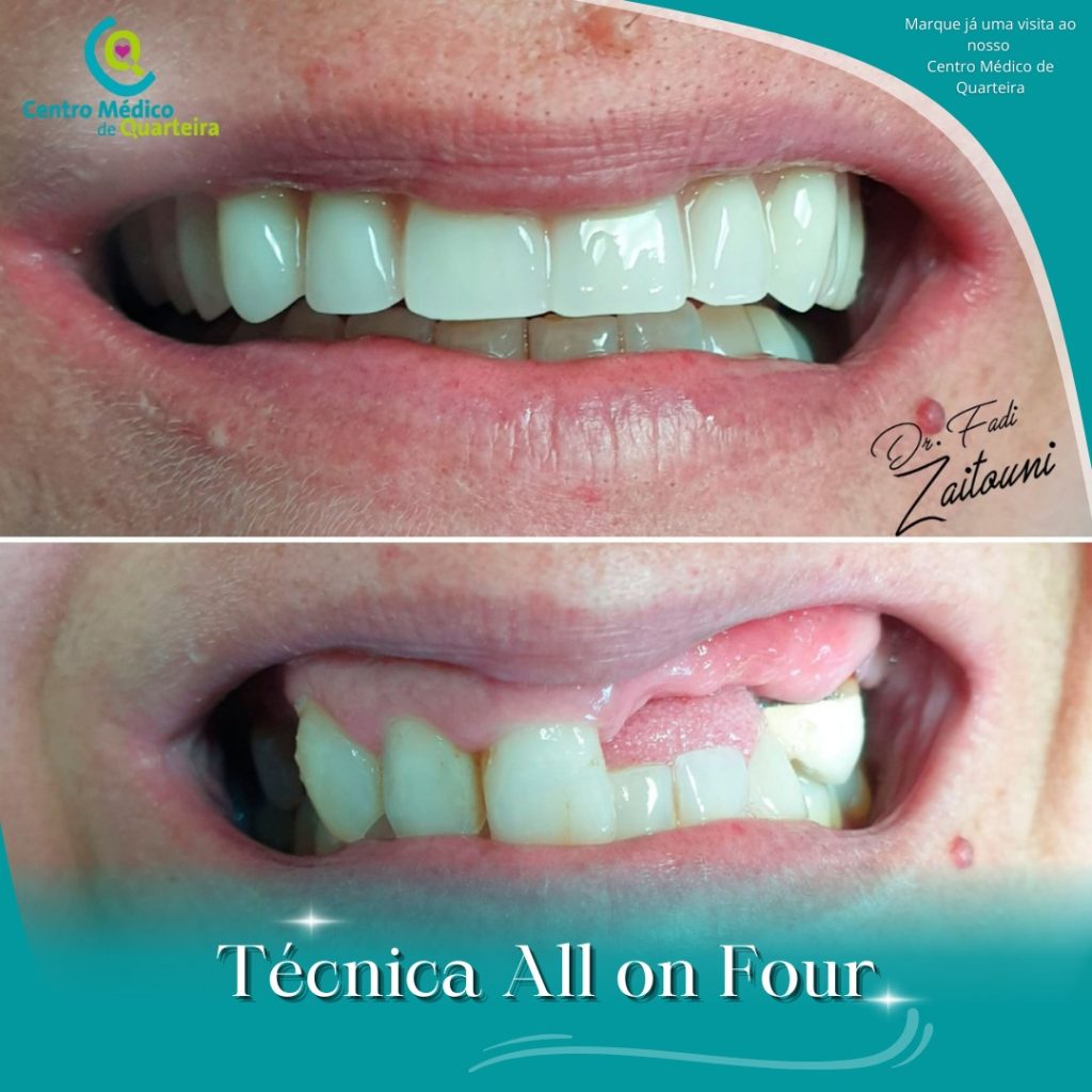 casos clinicos centro medico de quarteira