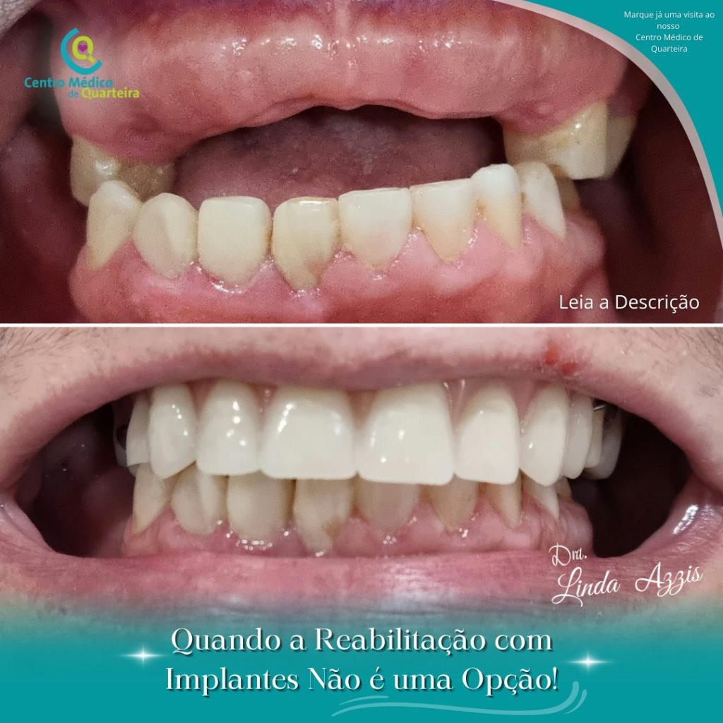 casos clinicos dentista