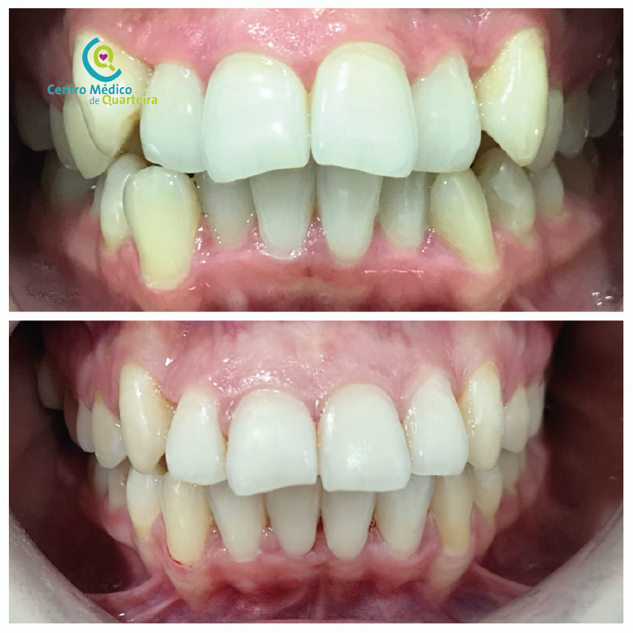 casos clinicos quarteira