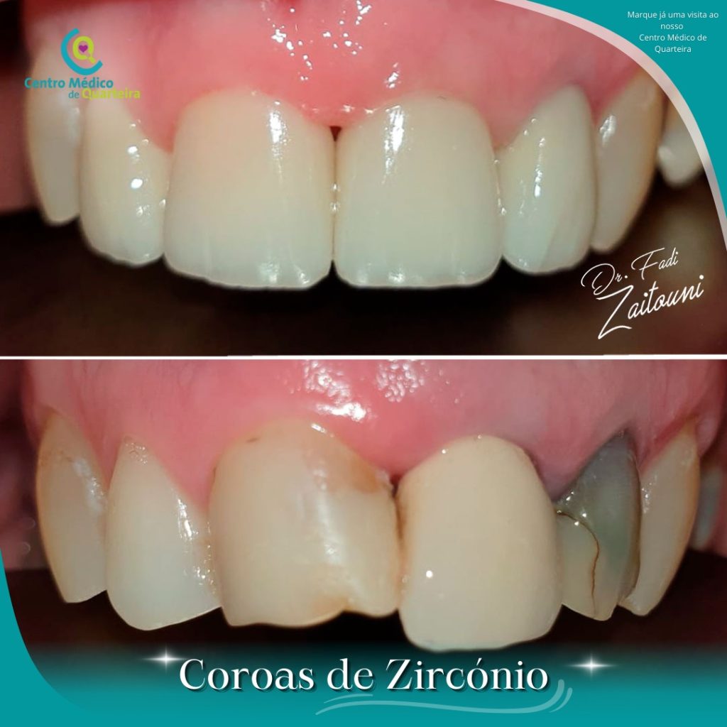 dentista em quarteira